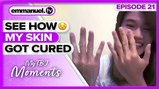 How T.B. Joshua's God Healed My Ailing Skin